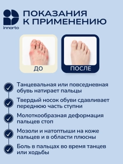 Вкладыши для пуант защита на ноги