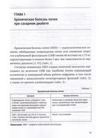Хроническая болезнь почек при комобридной патологии - сахарном диабете 2-го типа и первичном гипотиреозе