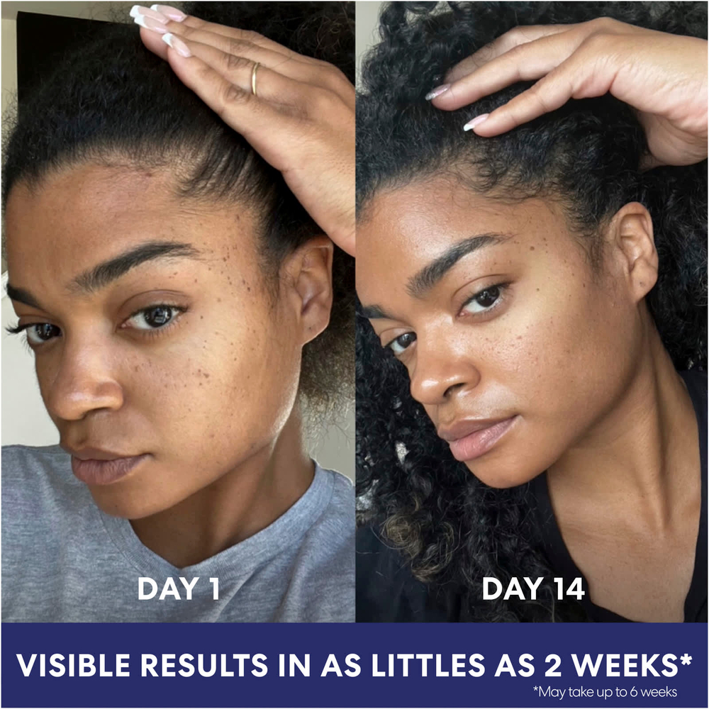 Palmer's, Skin Success With Vitamin E, Крем для лица против темных пятен, 2,7 унции (75 г)