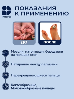 Защитные напальчники для ног от мозолей