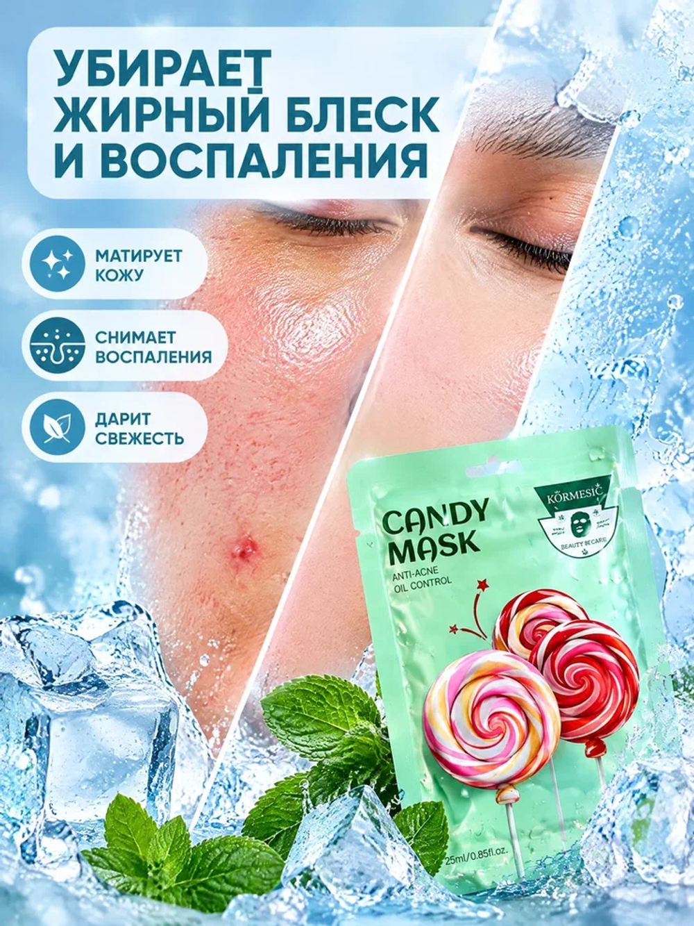 Маска для лица KORMESIC от акне и прыщей, 25 мл