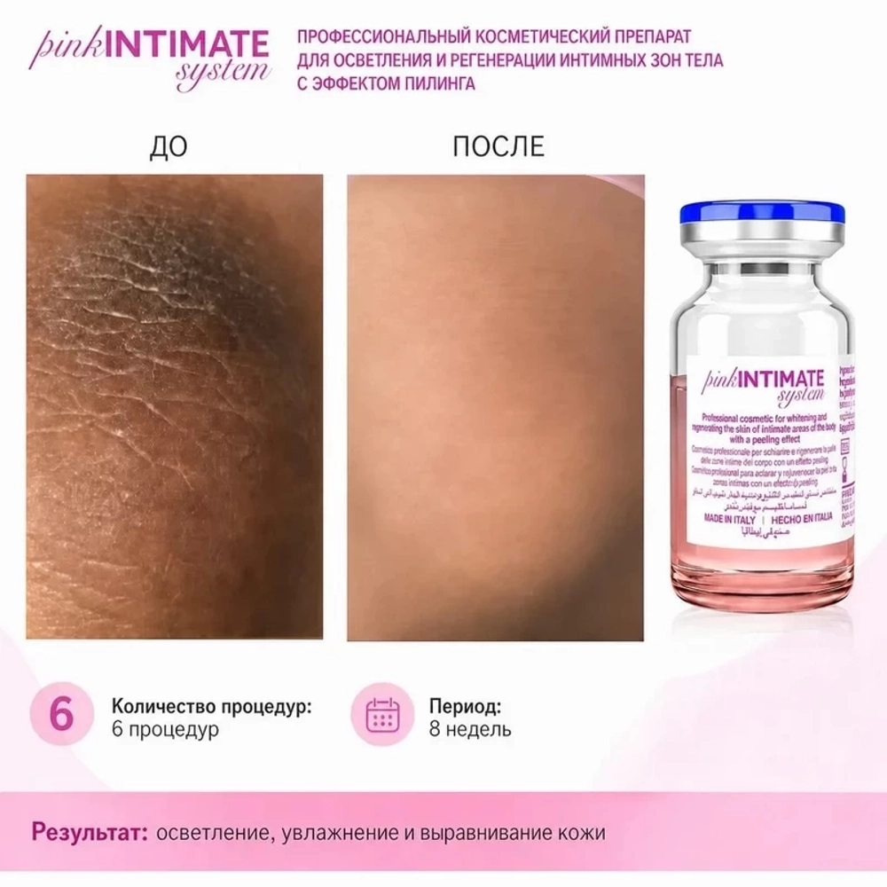 Pink Intimate System