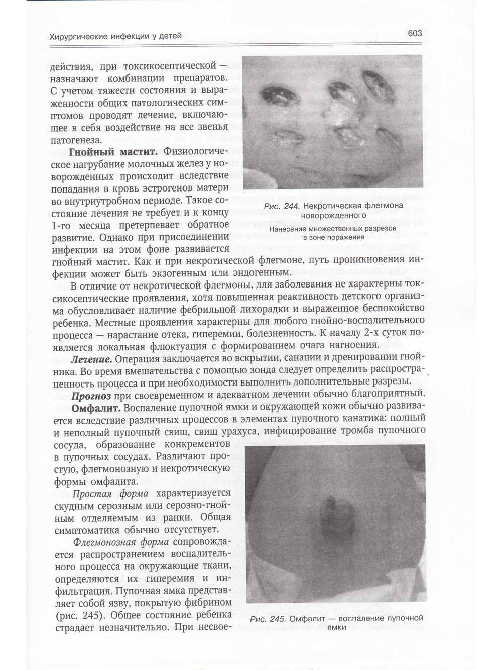 Госпитальная хирургия т.2 2-е издание