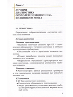 Лучевая диагностика опухолей и опухолевидных заболеваний позвоночника и спинного мозга
