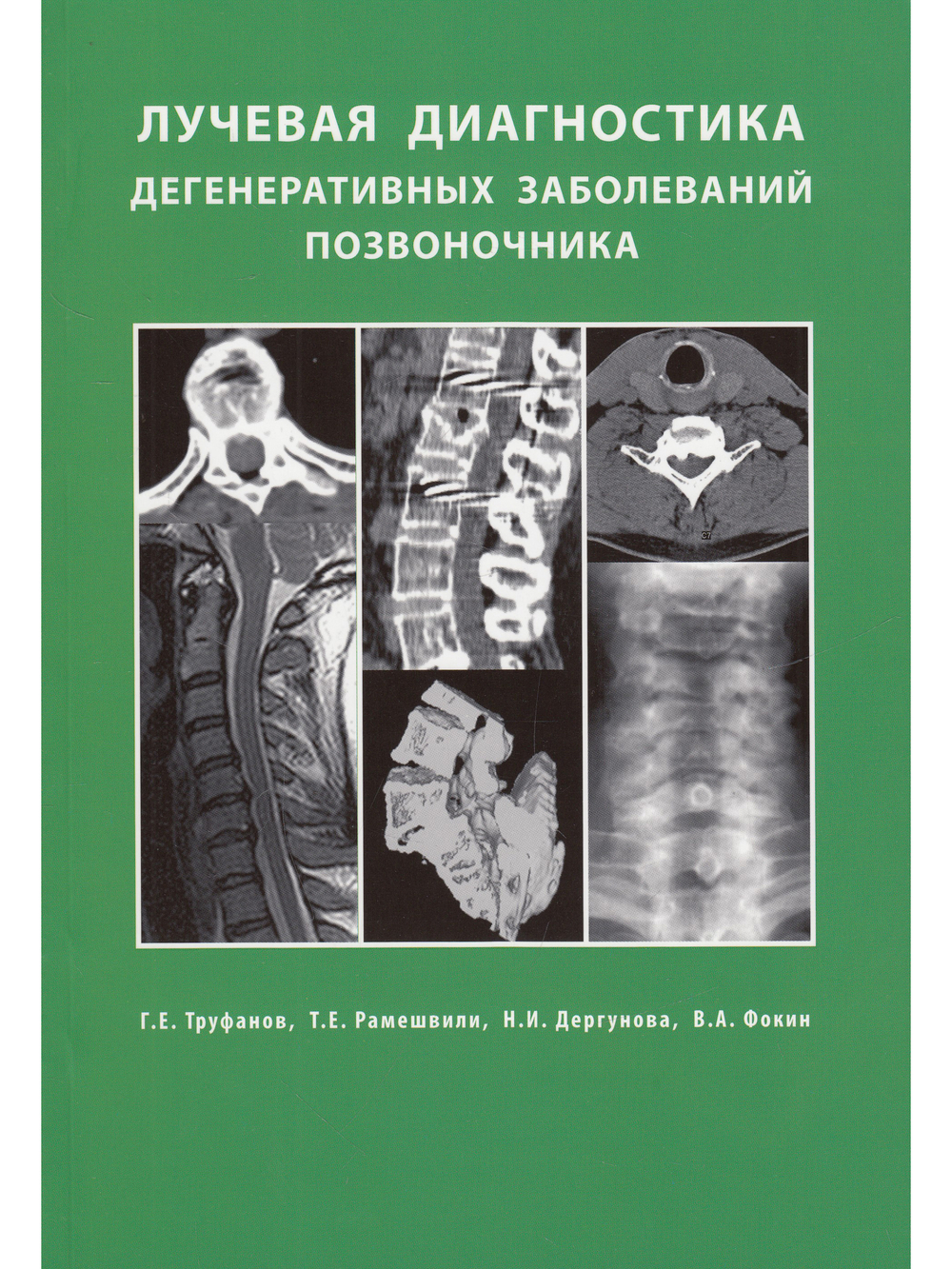 Лучевая диагностика  дегенеративных заболеваний позвоночника 3-е излание