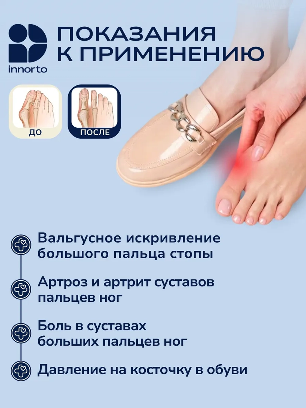 Вальгусный корректор большого пальца