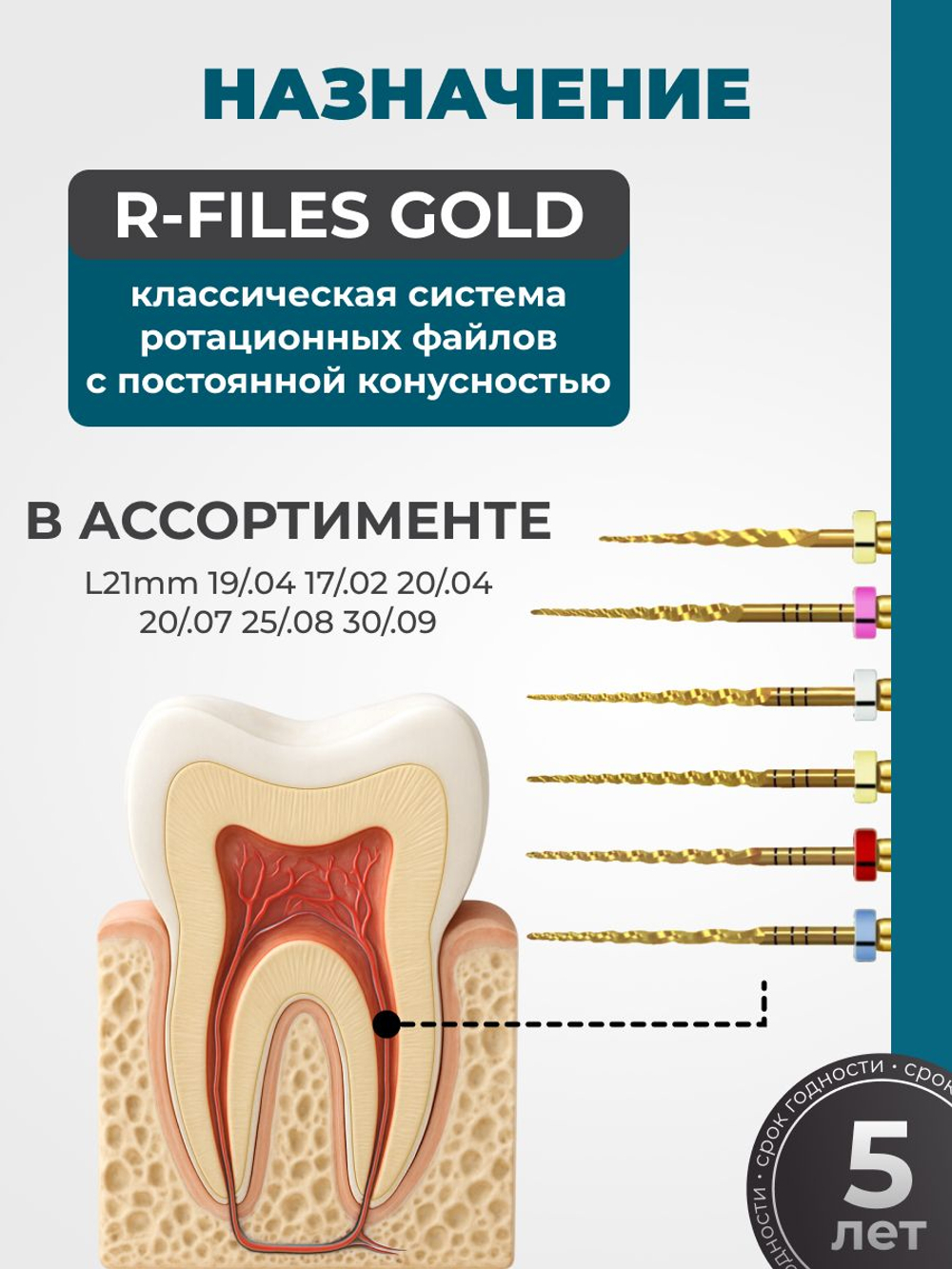 Машинные эндодонтические инструменты STEA R-Files Gold классические для первичной эндодонтии, 19мм и 21мм