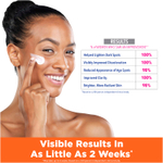 Palmer's, Skin Success® с витамином E, крем для обесцвечивания пигментных пятен для жирной кожи, 75 г (2,7 унции)