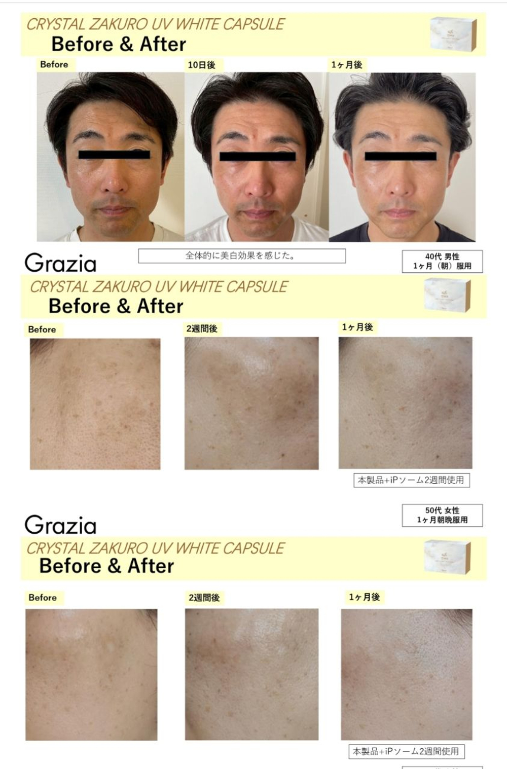 Комплекс для UV-защиты и отбеливания кожи,  профилактики фотостарения DIREIA CRYSTAL ZAKURO UV WHITE CAPSULE , 30 шт.