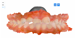 Интраоральный 3D сканер MaxOral V1