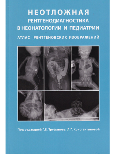 Неотложная рентгенодиагностика в неонатологии и педиатрии (Атлас рентгеновских изображений). Руководство для врачей