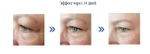 Eye Total Elixir - Суперлифтинговый эликсир для кожи вокруг глаз, 15 мл