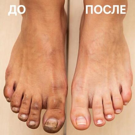 Педикюр