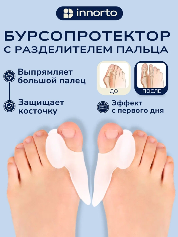Бурсопротектор для стопы (большого пальца)