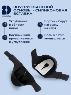 Подпяточники ортопедические при пяточной шпоре