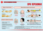 Плакаты "Первая медицинская помощь" (11 шт., А3)