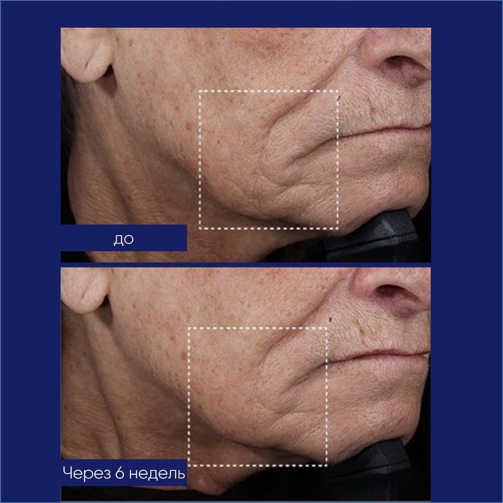Obagi ELASTIderm® Lift Up & Sculpt Facial Moisturizer Увлажняющий крем для лифтинга и скульптурирования лица 50 мл