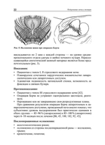 Недержание мочи у женщин: современные возможности консервативного и хирургического лечения: