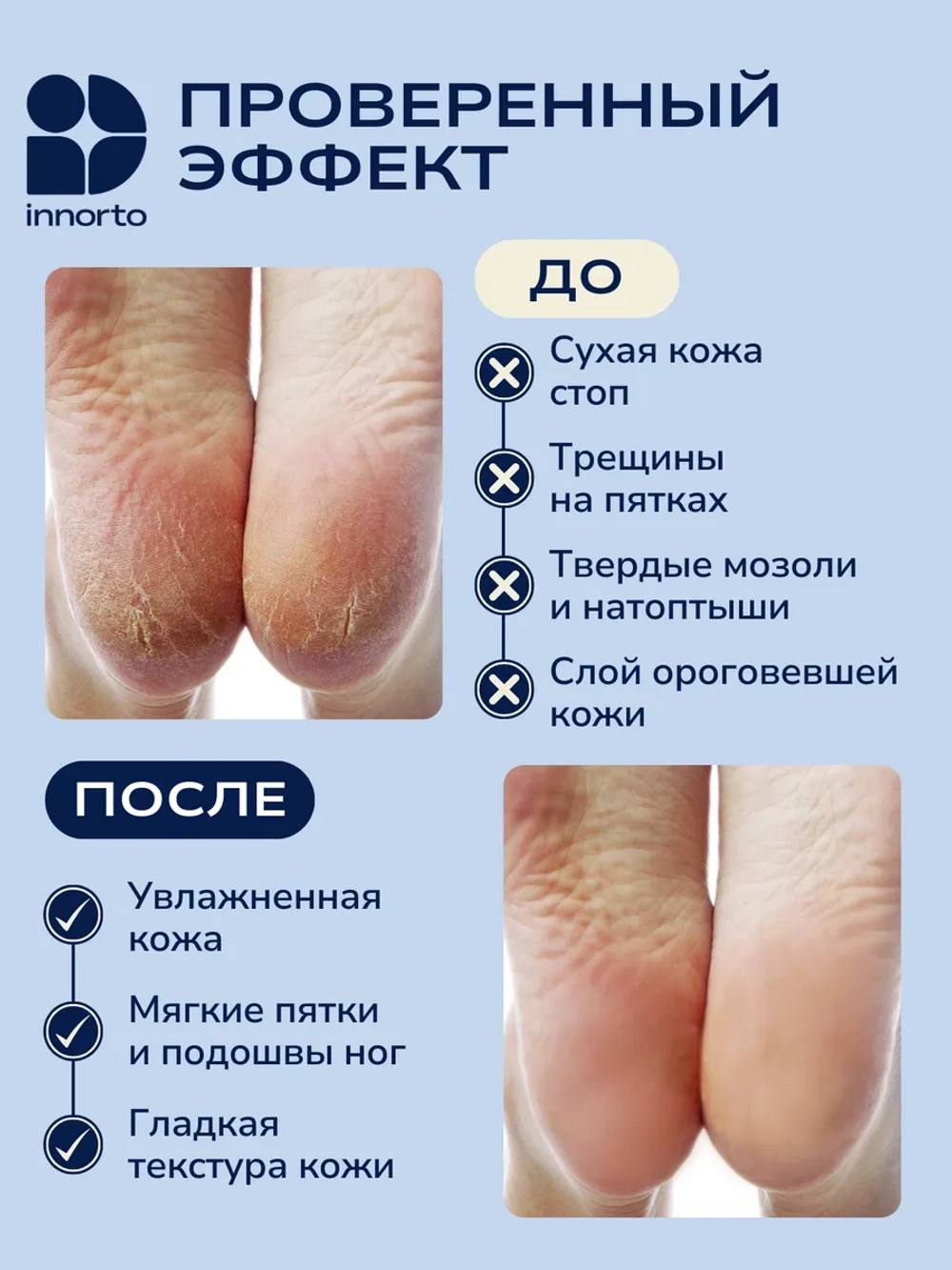 Силиконовые напяточники с перфорацией, набор 4 шт