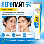 Гель ПЕРОЛАЙТ 5%