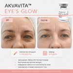 Eye's Glow Akvavita | ГК 15 мг/мл+Глутатион+Трегалоза