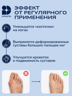 Тренажёр, вальгусный корректор большого пальца