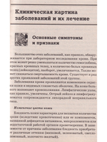 Лечение заболеваний крови