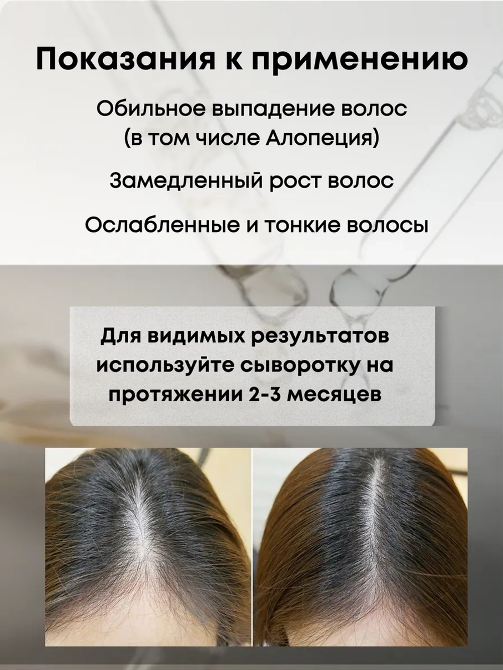 Сыворотка для роста волос