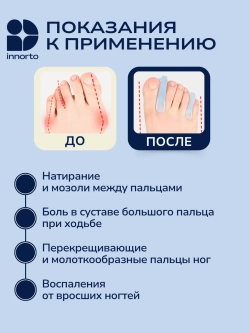 Разделители с коррекцией пальцев