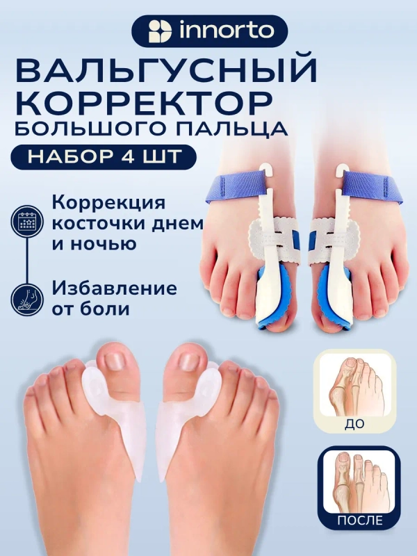 Вальгусный корректор большого пальца (набор)