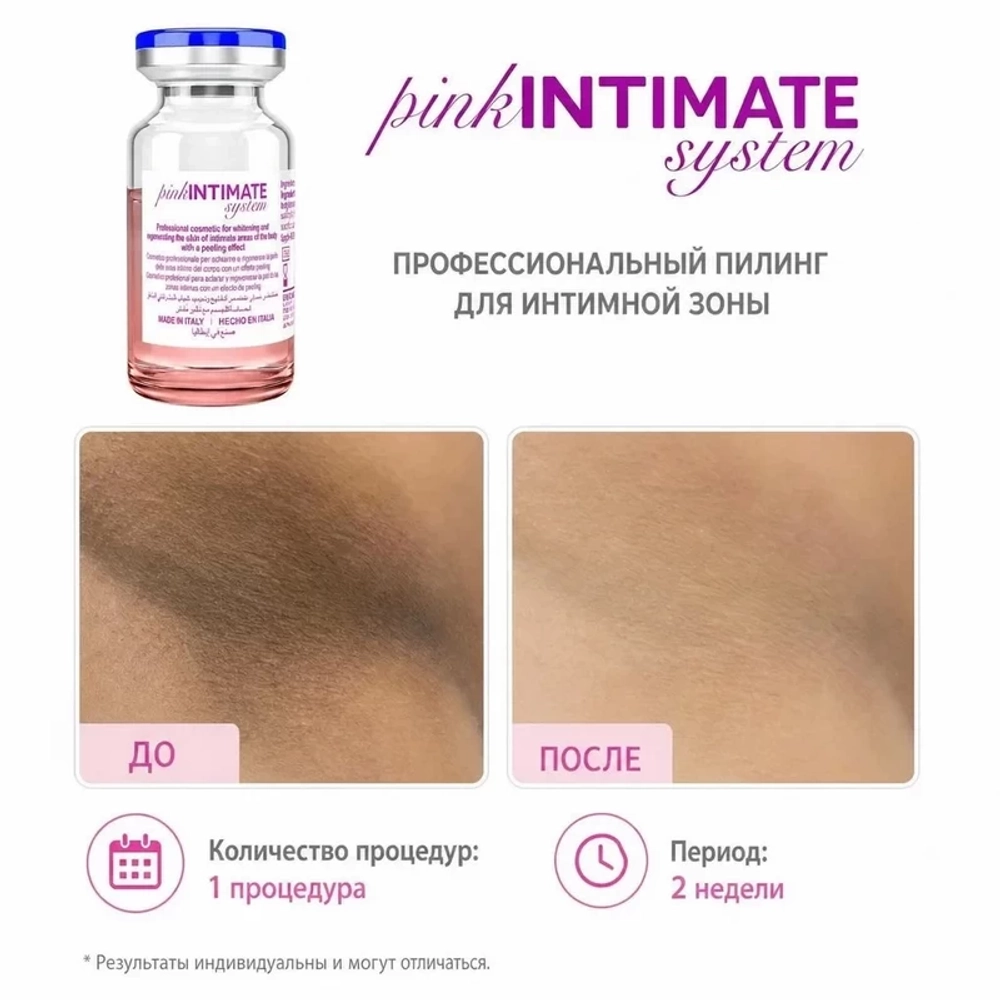 Pink Intimate System