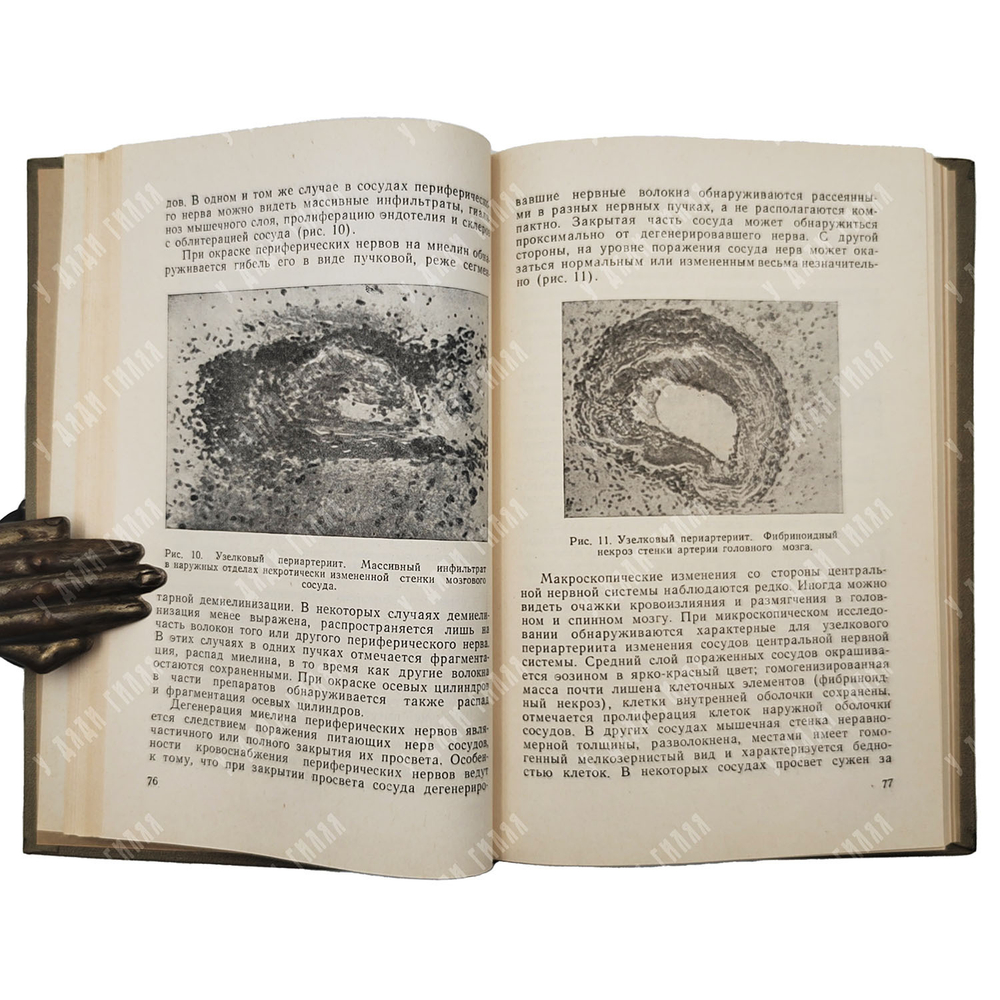 Лурье З. Л. Поражения нервной системы при внутренних болезнях, 1960.