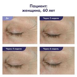 Obagi Medical Ночной крем для век Elastiderm Eye Treatment Cream, 15 гр