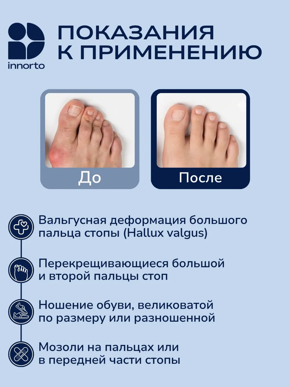 Полустельки в туфли силиконовые женские, пара