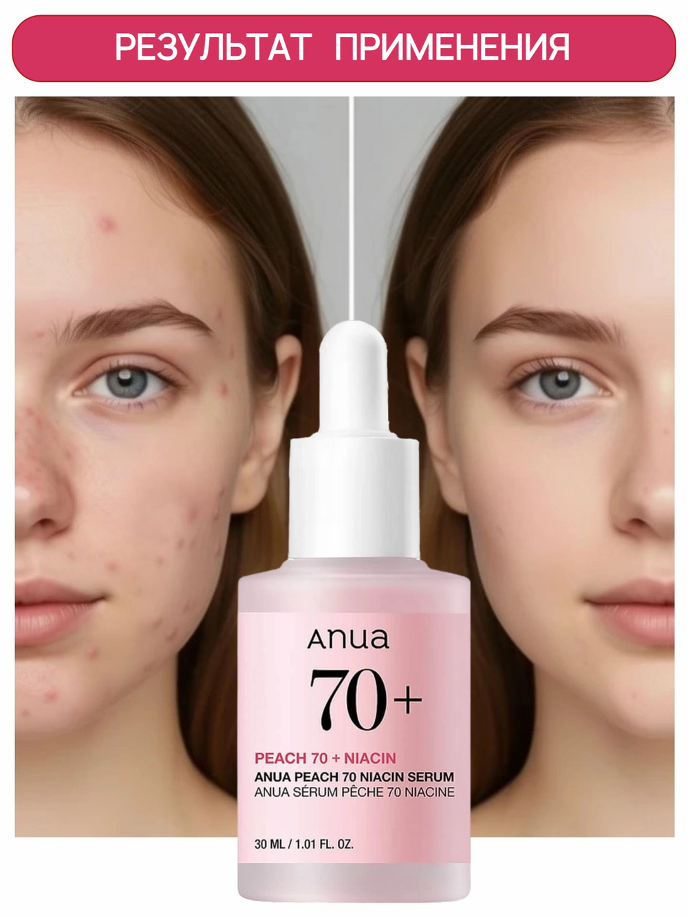 ANUA Сыворотка с экстрактом персика и ниацинамидом Peach 70% Niacin Serum