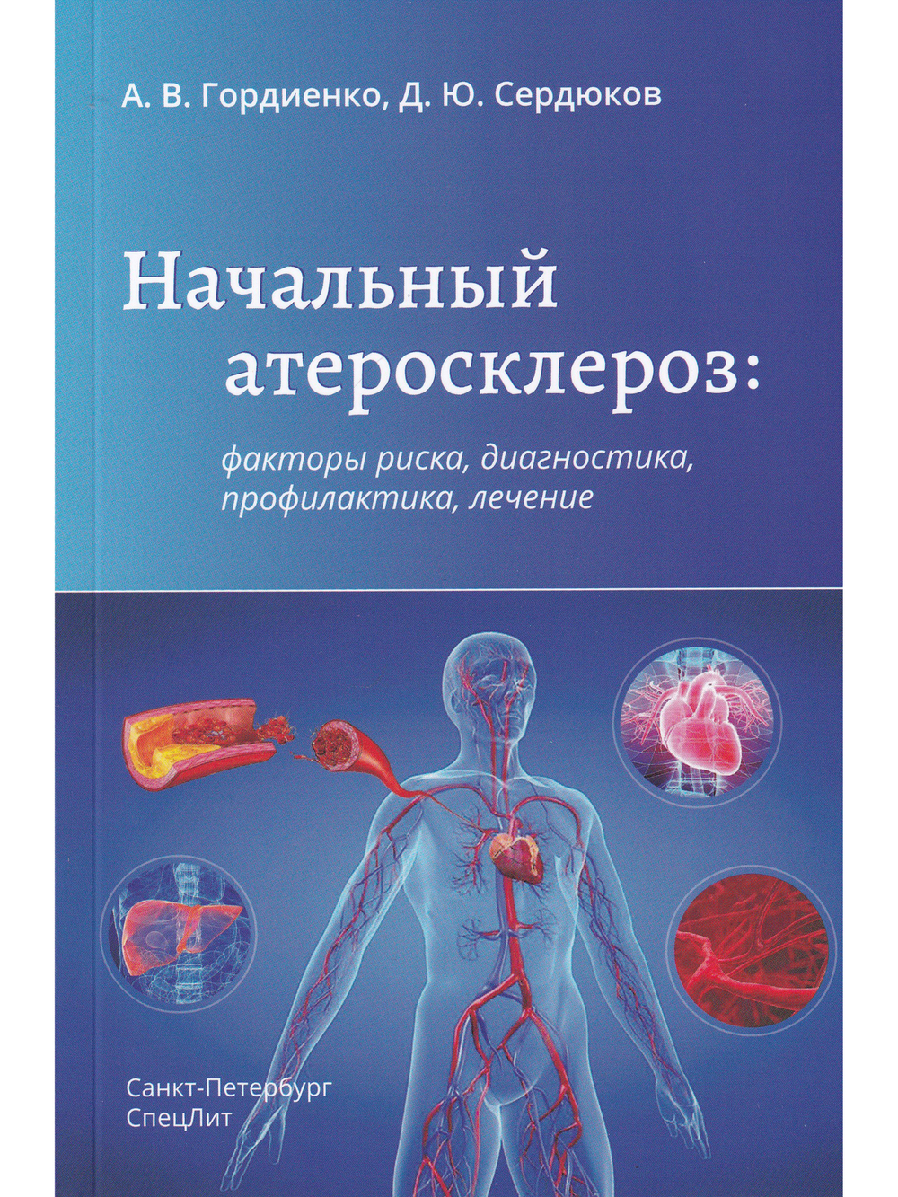Начальный атеросклероз: факторы риска, диагностика, профилактика, лечение
