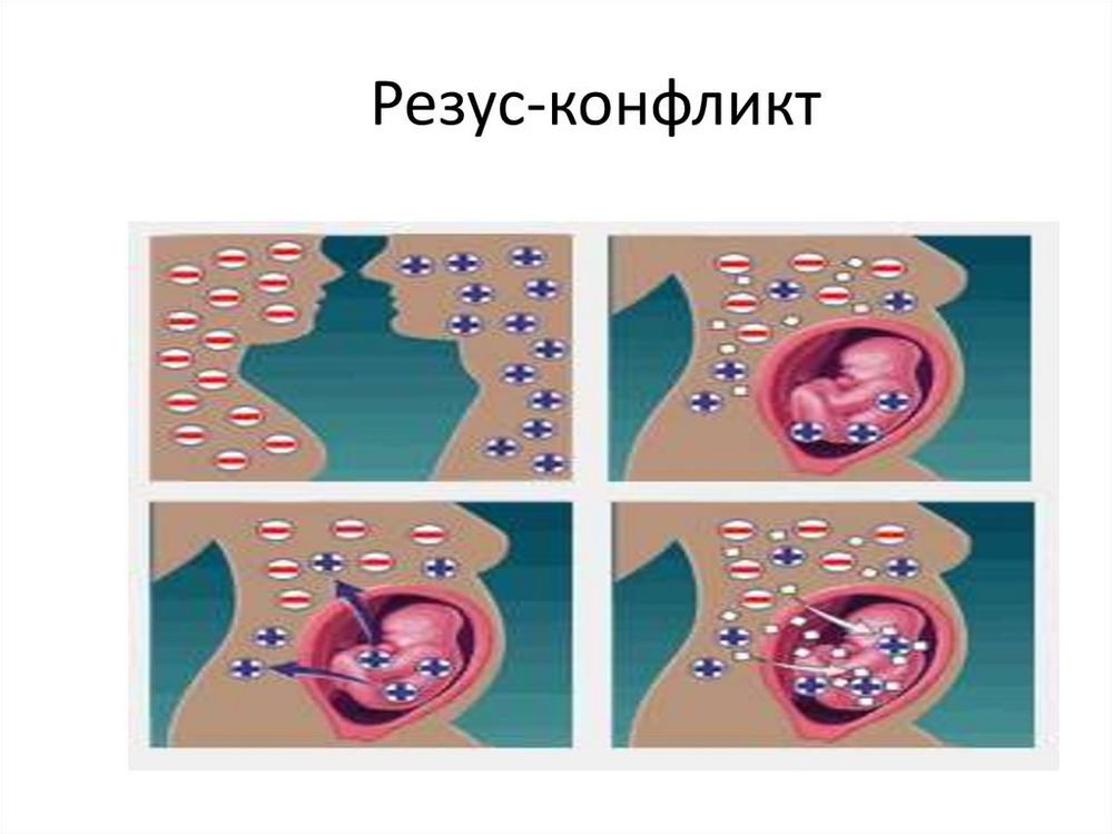 Модель-аппликация Наследование резус-фактора — купить по ФГОС | Учебный стандарт