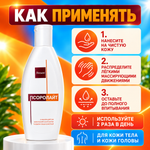 ПСОРОЛАЙТ ЛОСЬОНЫ
