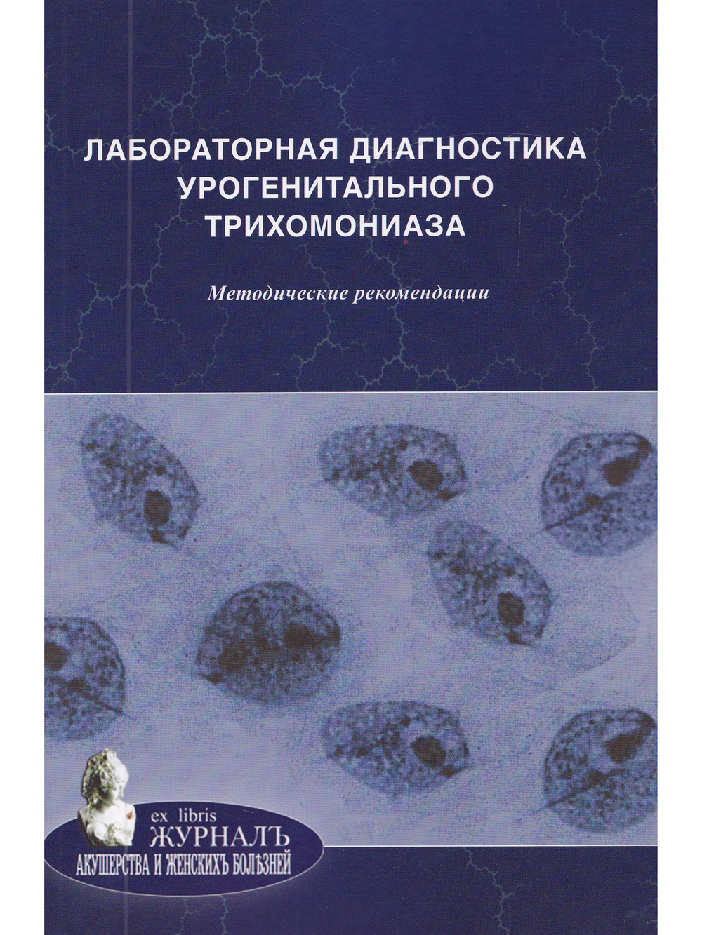Лабораторная диагностика урогенитального трихомониаза: методические рекомендации