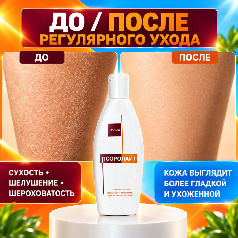 ПСОРОЛАЙТ ЛОСЬОНЫ