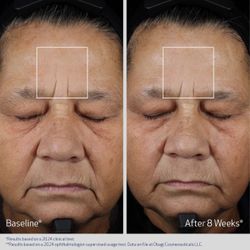 Obagi ELASTIderm Advanced Filler Concentrate Гель-концентрат от морщин 20 мл
