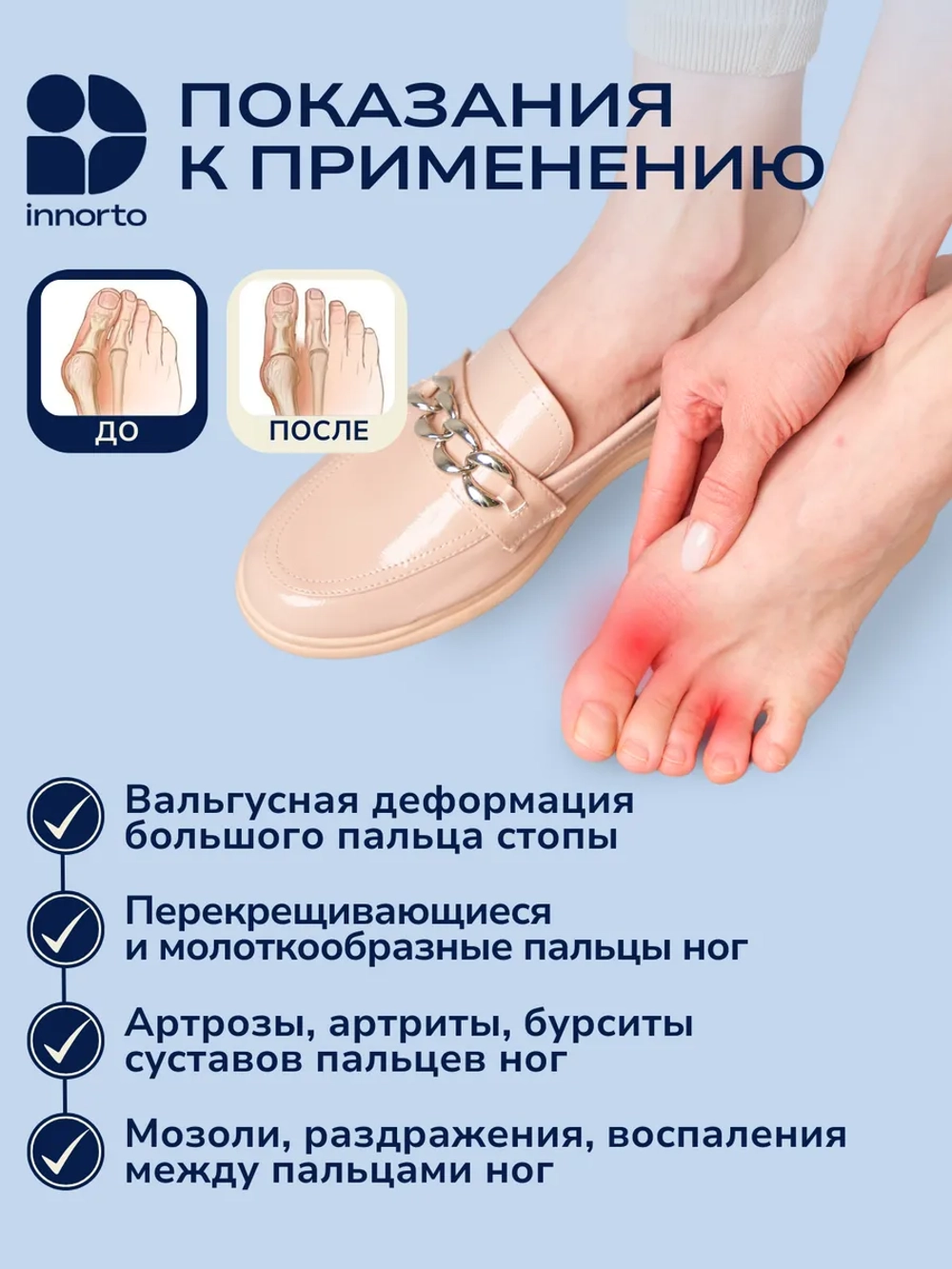 Силиконовый ортопедический разделитель пальцев