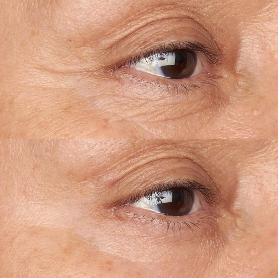 Perricone MD Крем для глаз Hypoallergenic Clean Correction Firming & Brightening Eye Cream