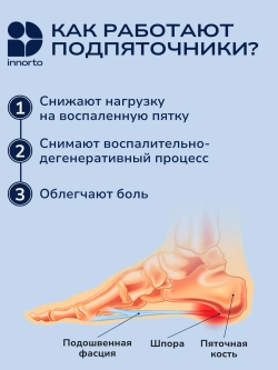 Подпяточники ортопедические при пяточной шпоре