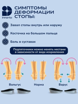 Ортопедические стельки вальгус подпяточник