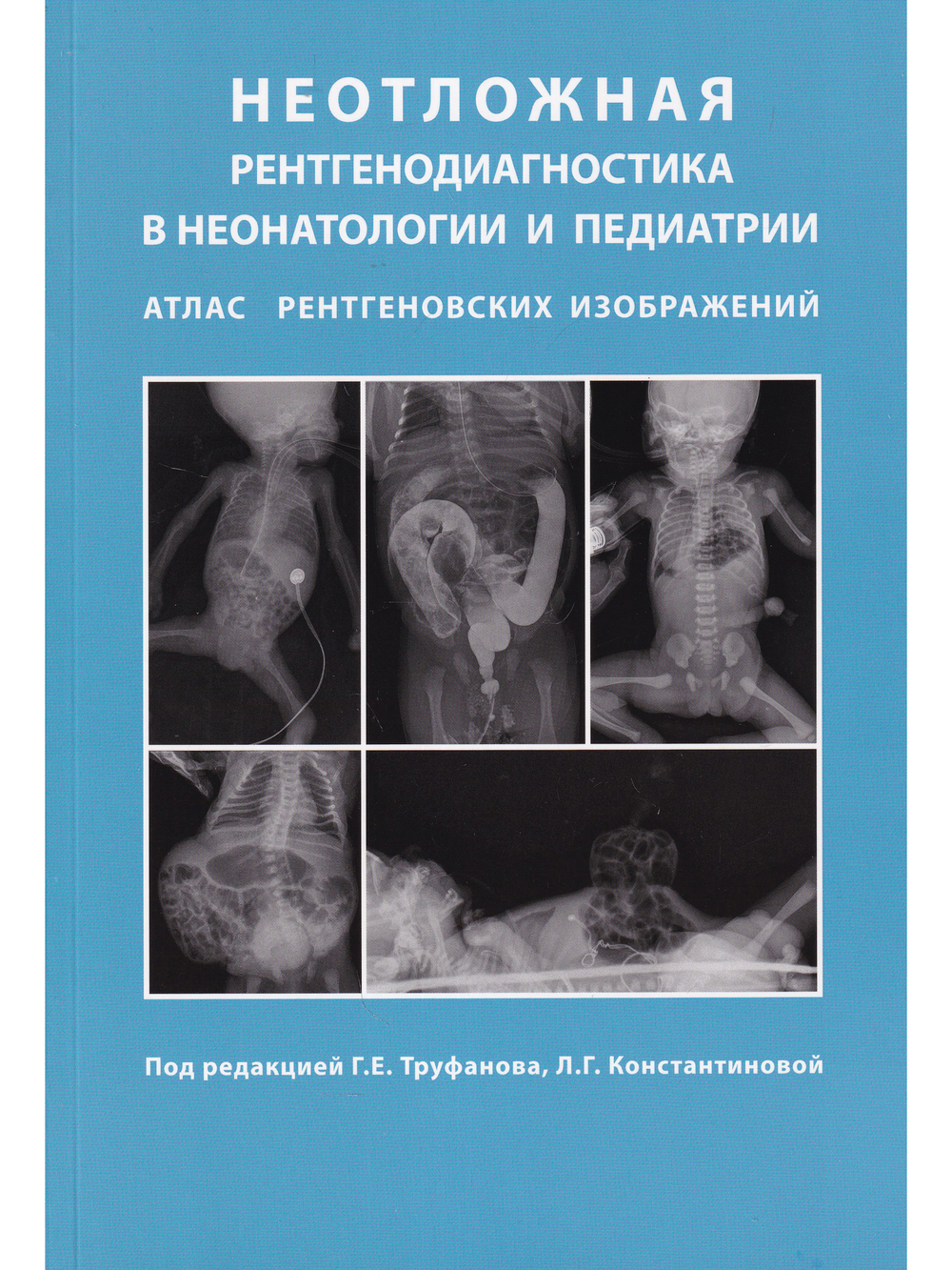 Неотложная рентгенодиагностика в неонатологии и педиатрии (Атлас рентгеновских изображений). Руководство для врачей