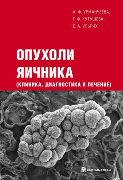 Опухоли яичника (клиника, диагностика и лечение)