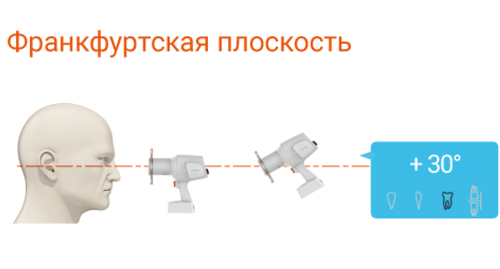 Аппарат рентгеновский дентальный портативный VATECH EzRay Air Portable