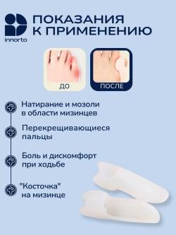 Бурсопротектор, разделители мизинца для ног