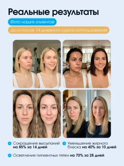светодиодная Led маска для фототерапии лица косметическая